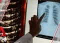 China pneumonia: Sars ruled out as dozens fall ill in Wuhan